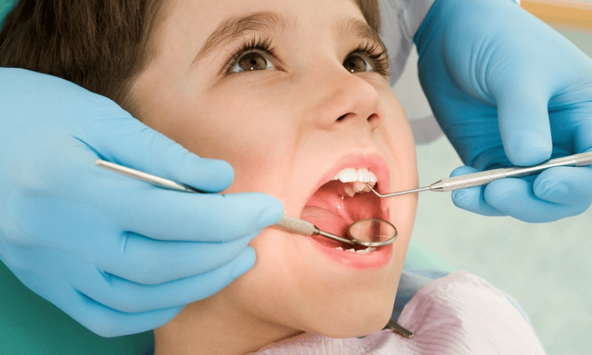 Dental Veneers for kids