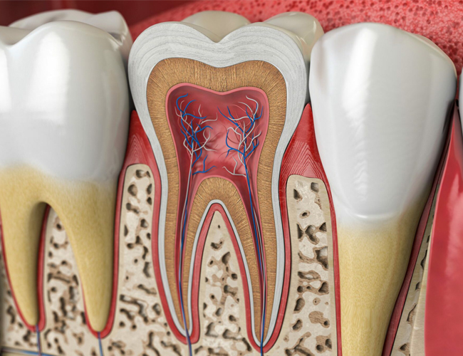 root canal therapy in lombard