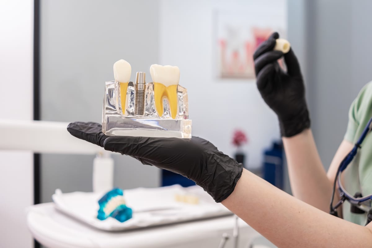 Dental Crowns in Villa Park